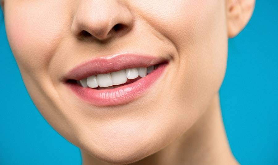 Teeth Whitening Options Explained